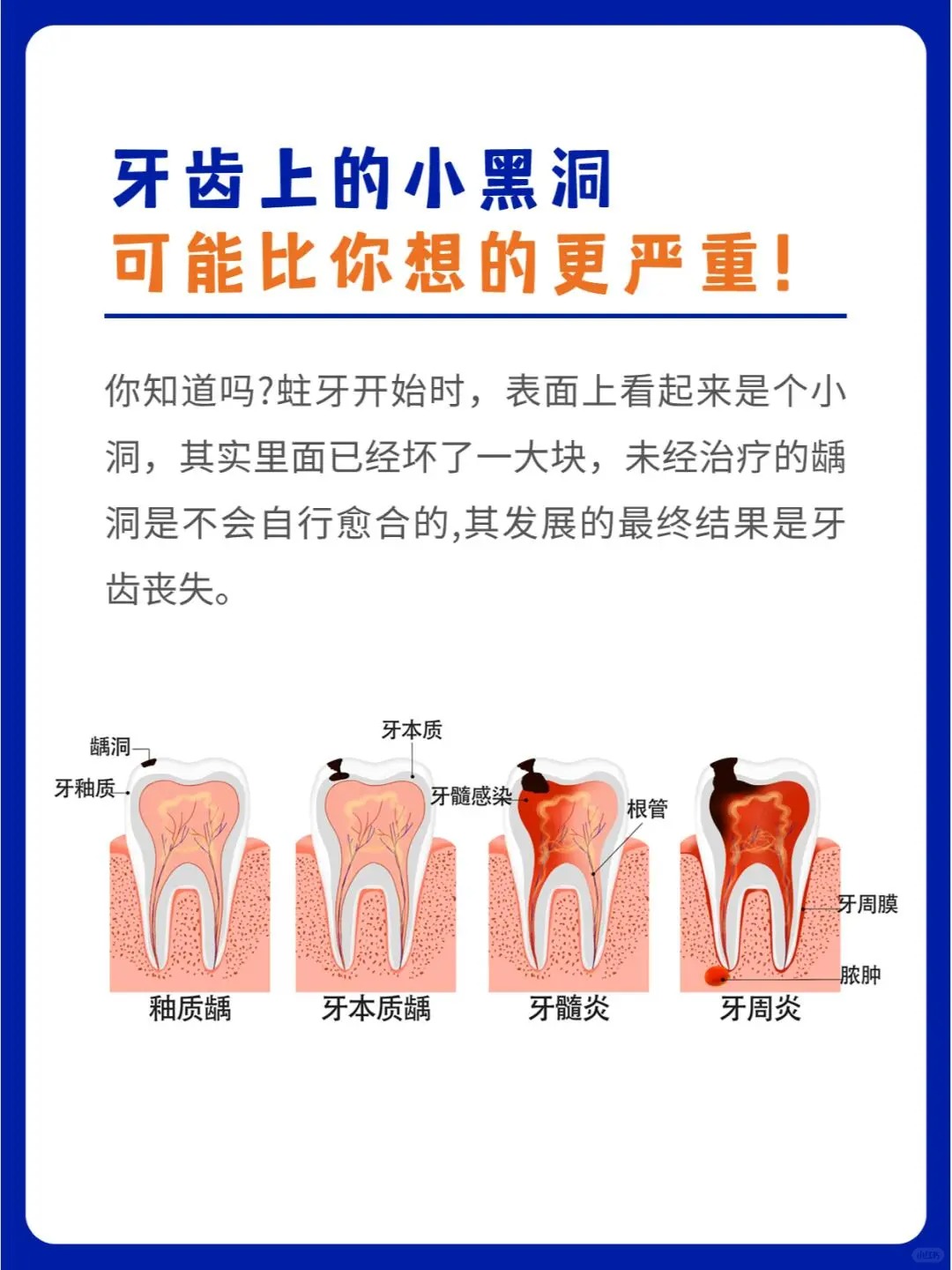 蛀牙为什么会疼