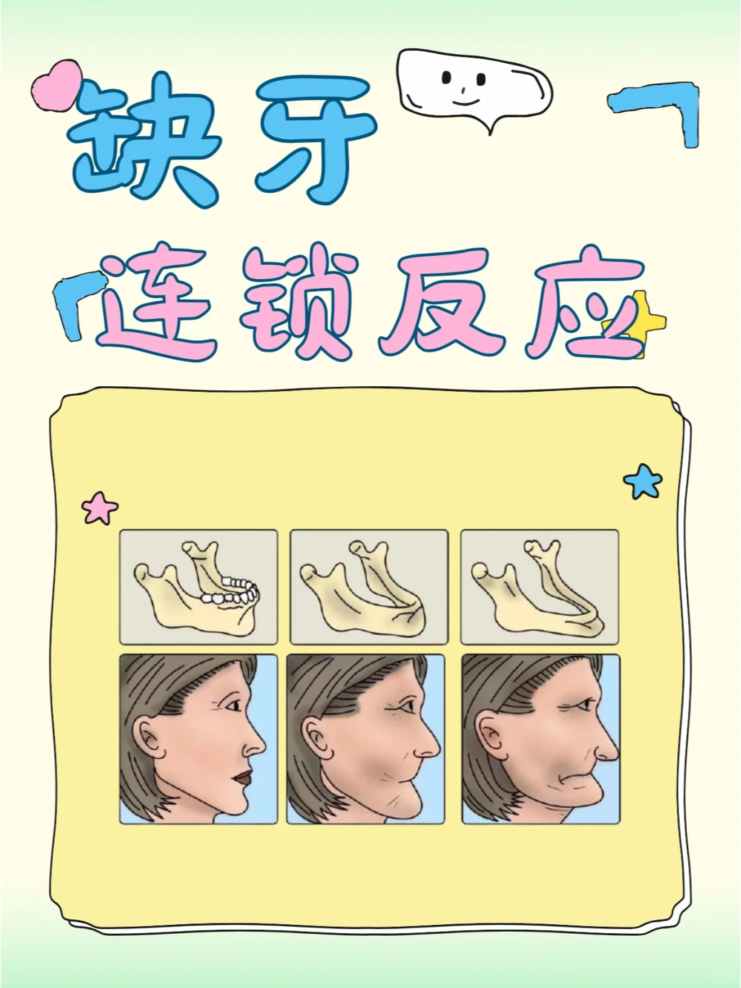 牙缺失会造成什么连锁反应呢?