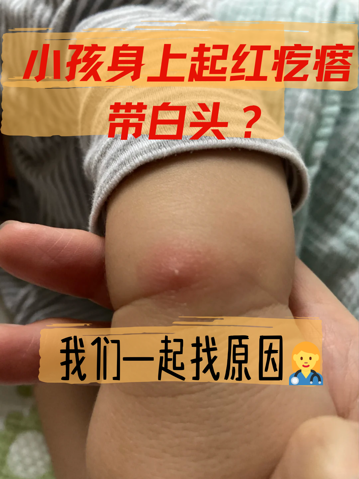 这是为什么呢下面我们一起来看看常见原因!
