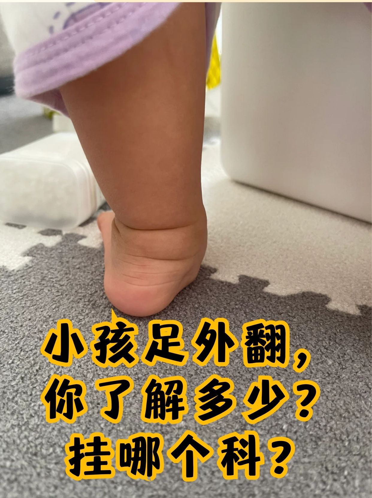 小孩足外翻,你了解多少?挂哪个科?