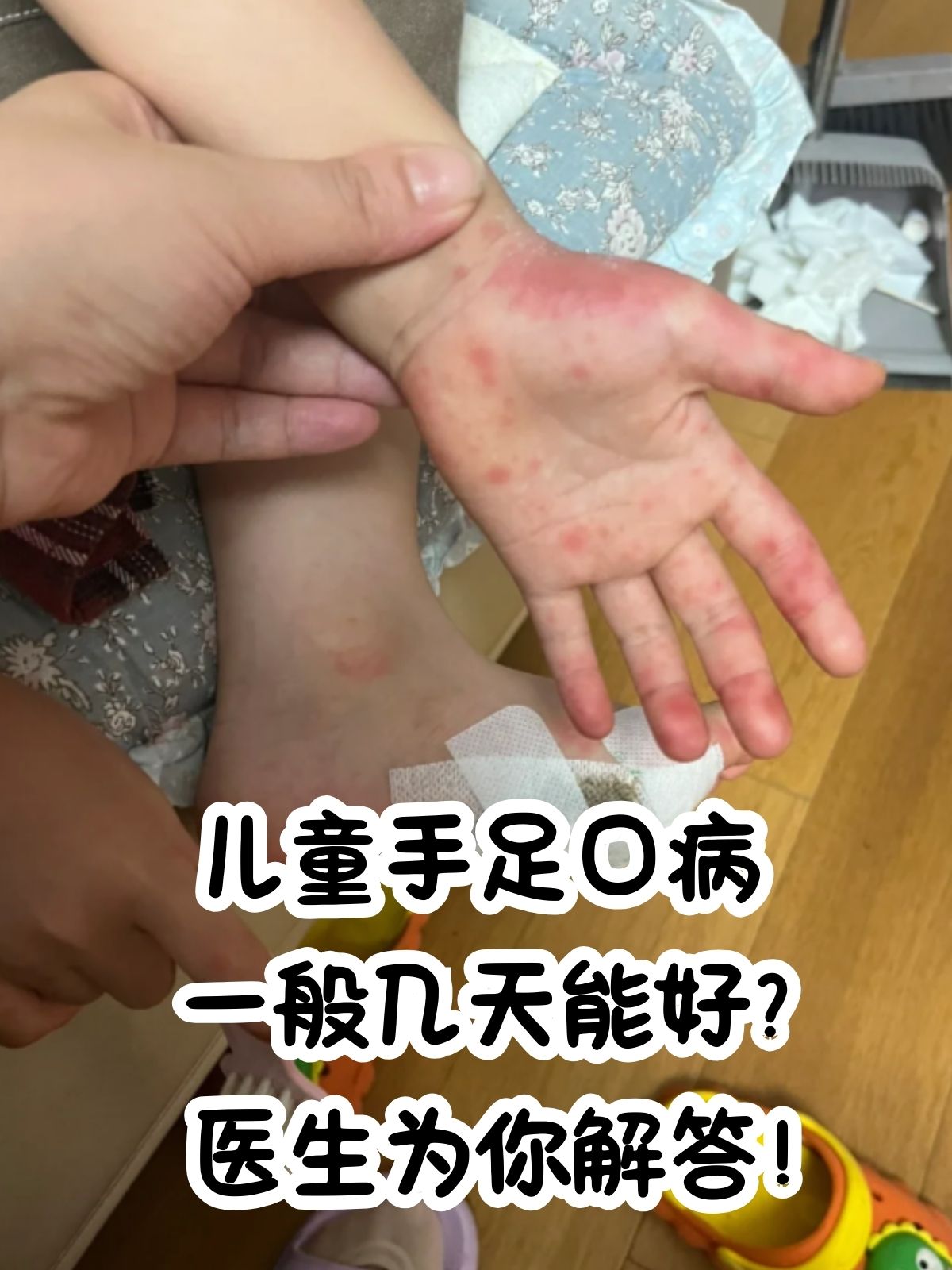 手足口病,作为一种在儿童群体中高发的传染性疾病,不仅给儿童们带来