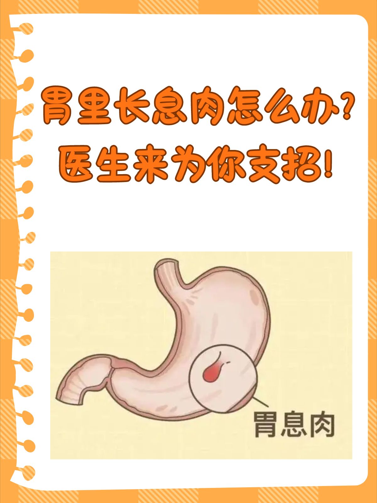 胃息肉的成因多种多样包括遗传因素幽门螺杆菌感染不良的生活习惯