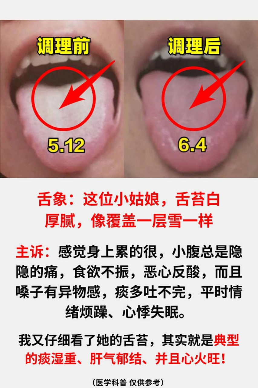 正常的舌苔图片 病症图片