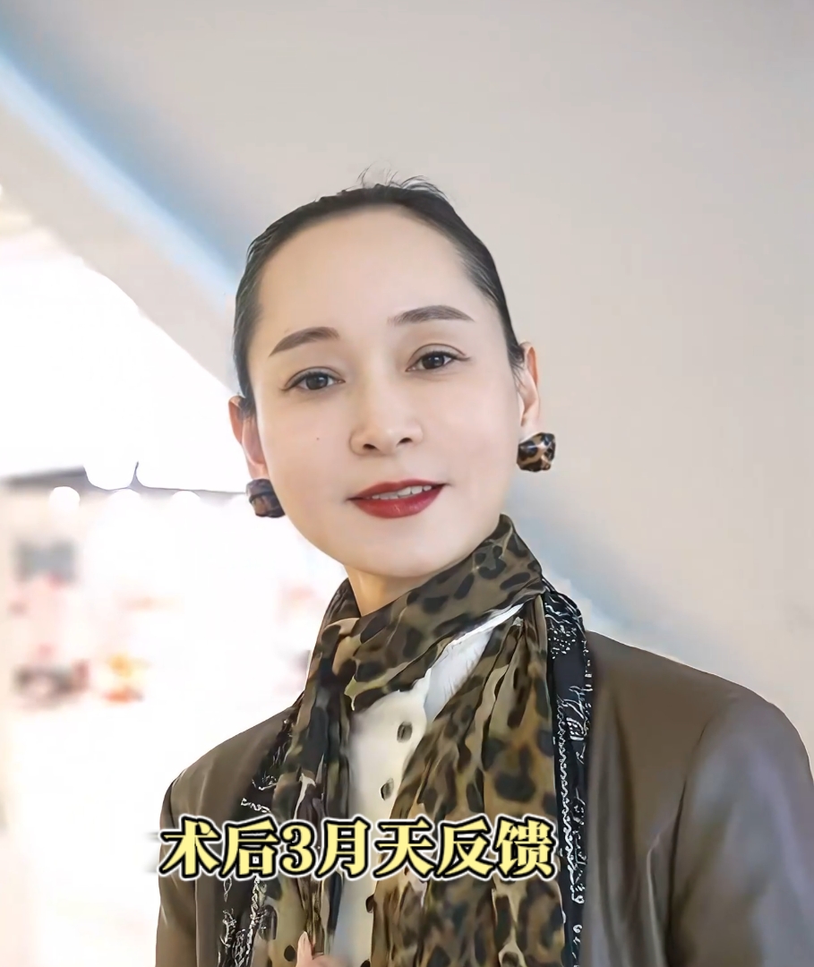 轮廓提升八大优势……