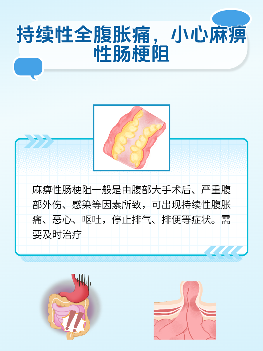 持续性全腹胀痛,小心麻痹性肠梗阻