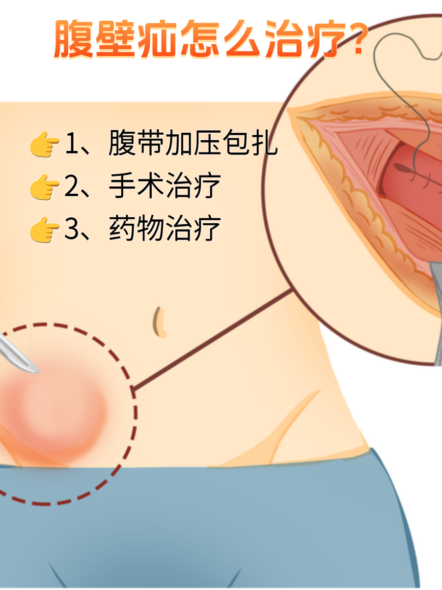 公猪脐疝手术图解图片