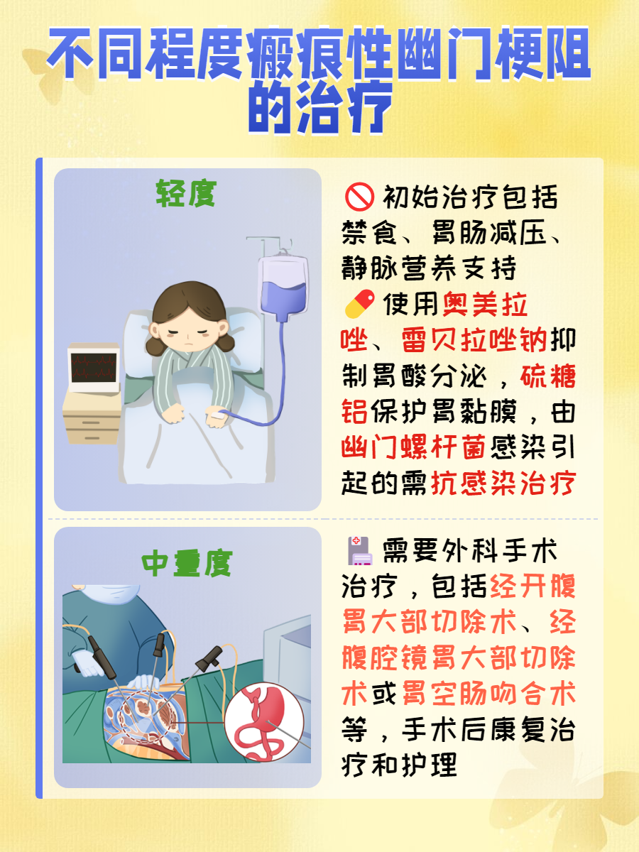 幽门梗阻怎样才算通了