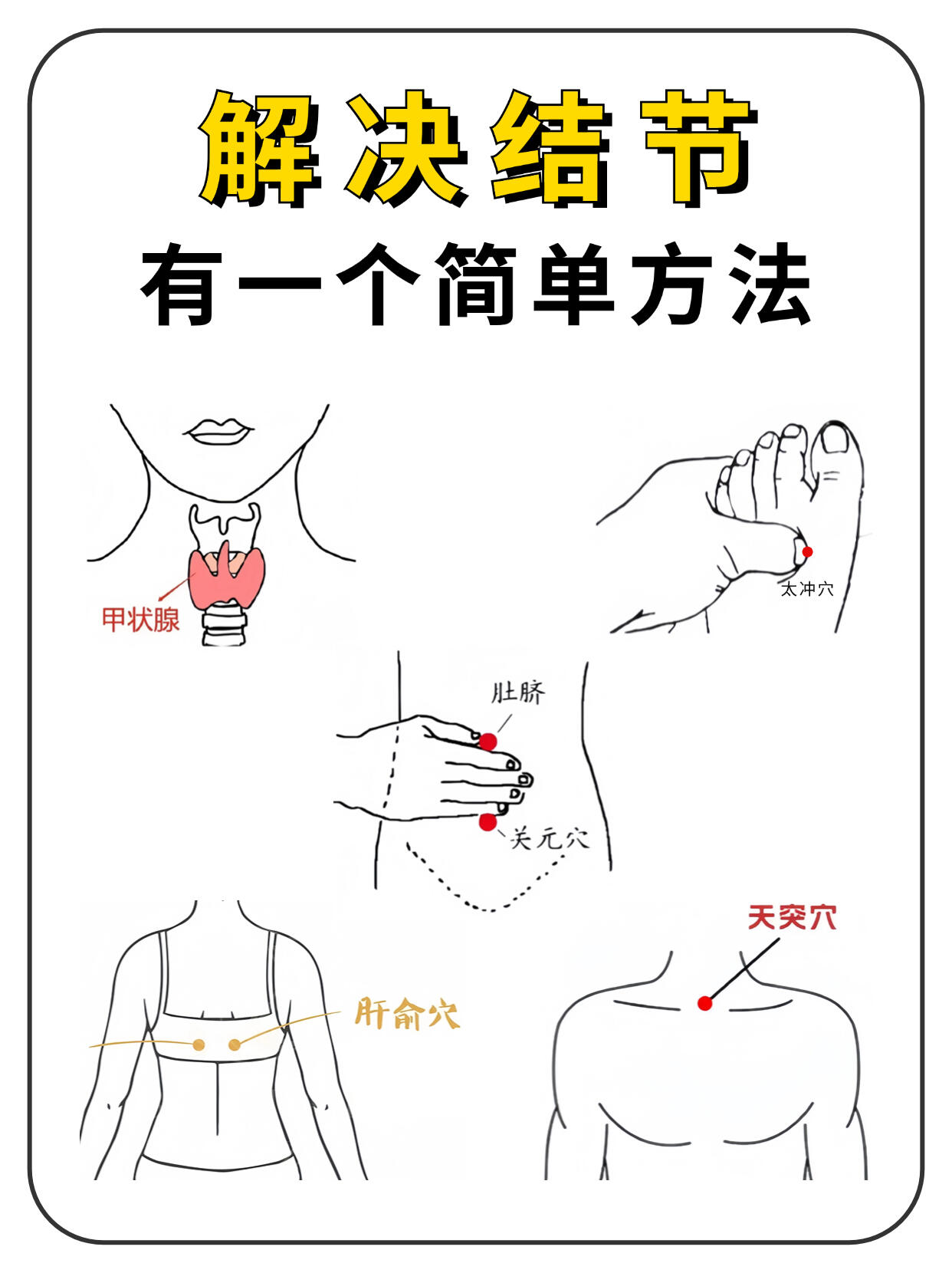 甲状腺结节艾灸位置图图片