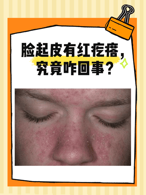 脸为什么会过敏