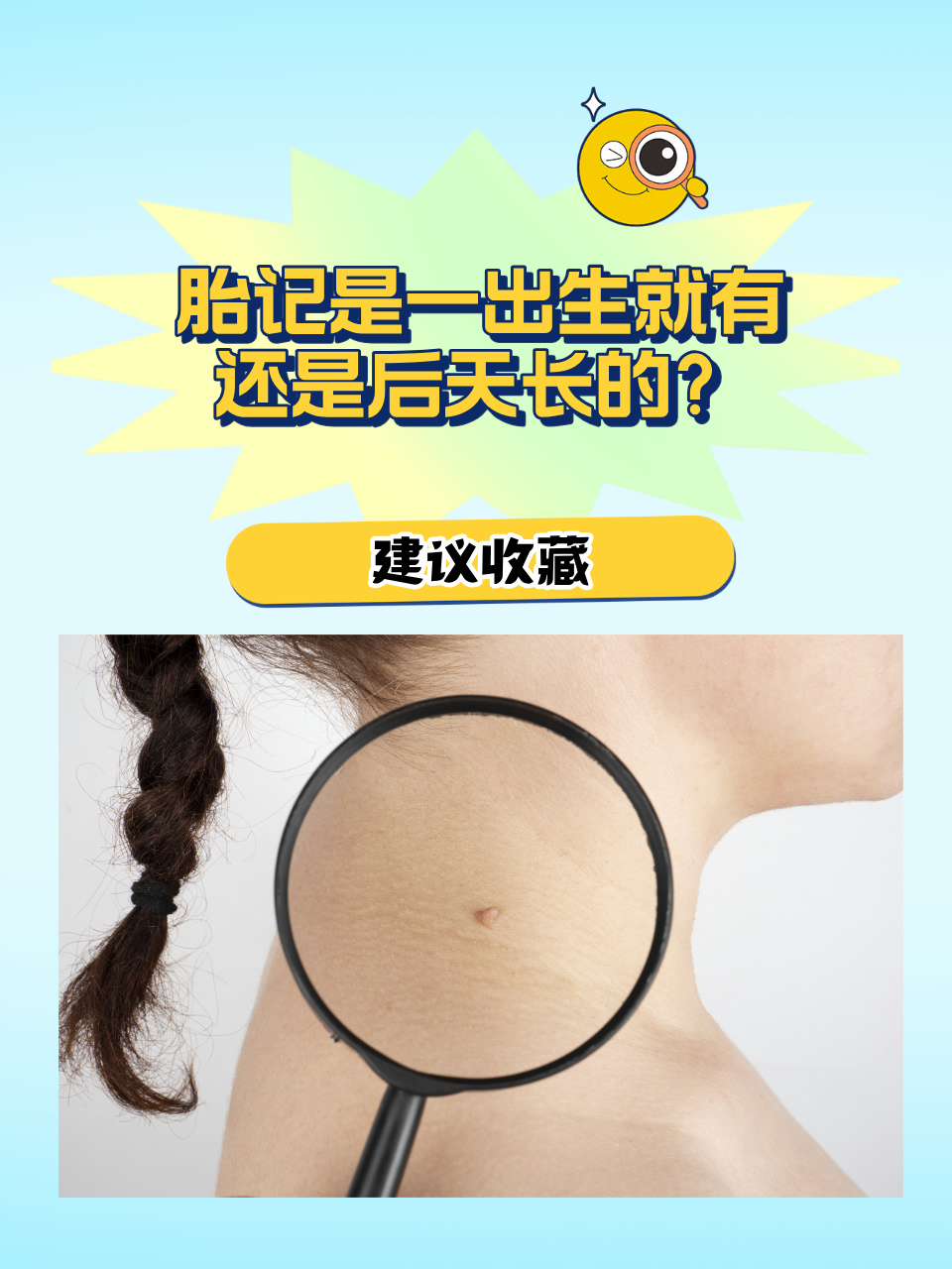 为什么会有胎记筛查为什么在线