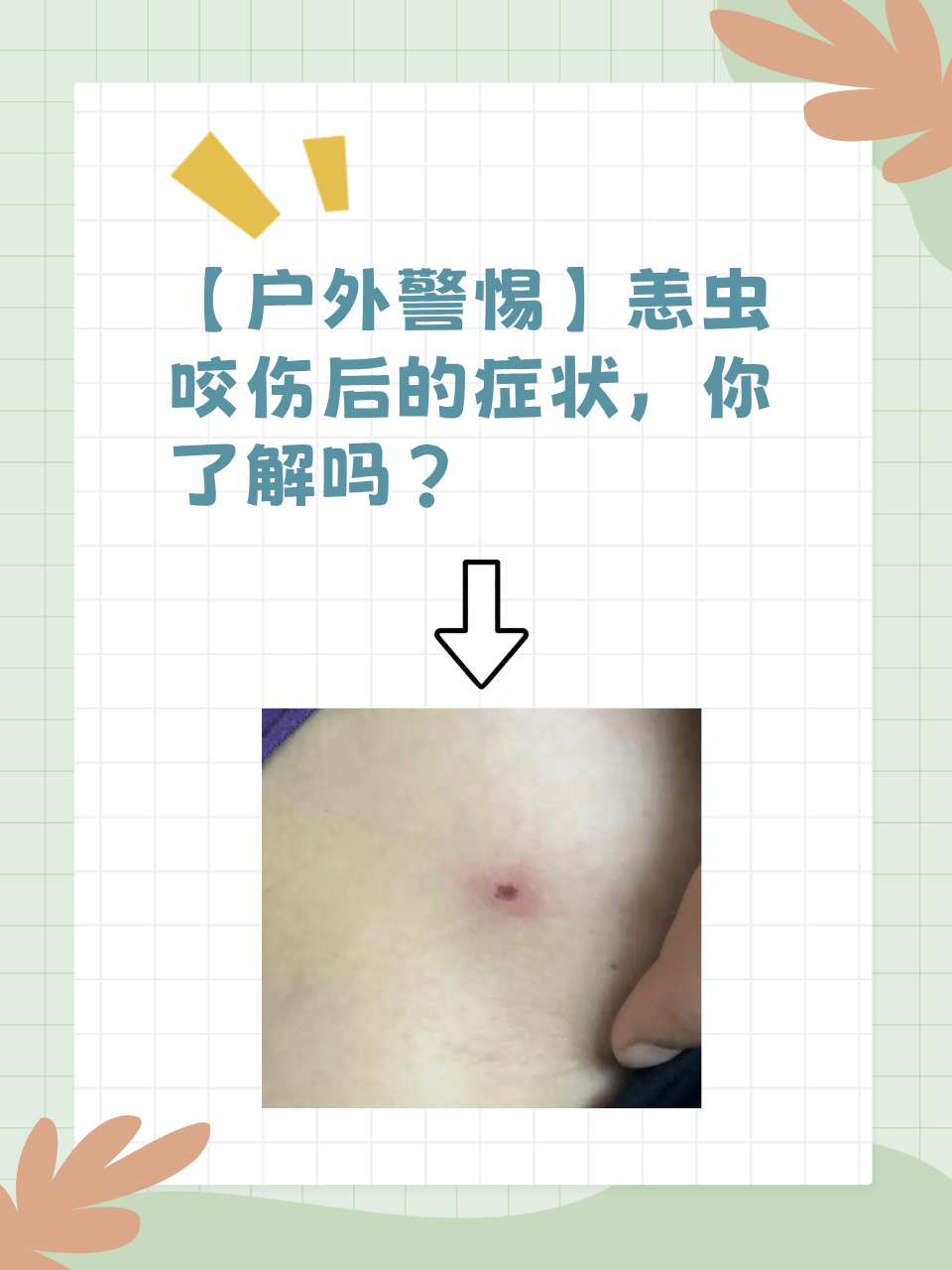 【户外警惕】恙虫咬伤后的症状,你了解吗?