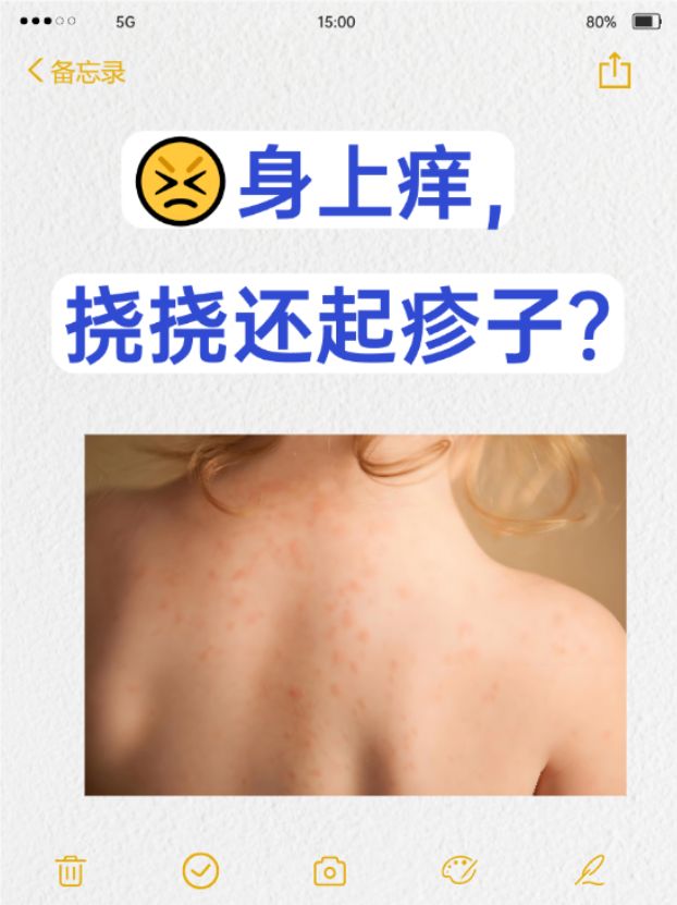 首先,身上痒且挠后起疹子可能由多种原因引起,比