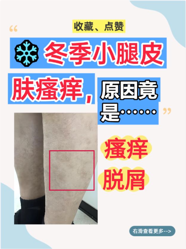 为什么小腿痒一抓就烂了百科在线
