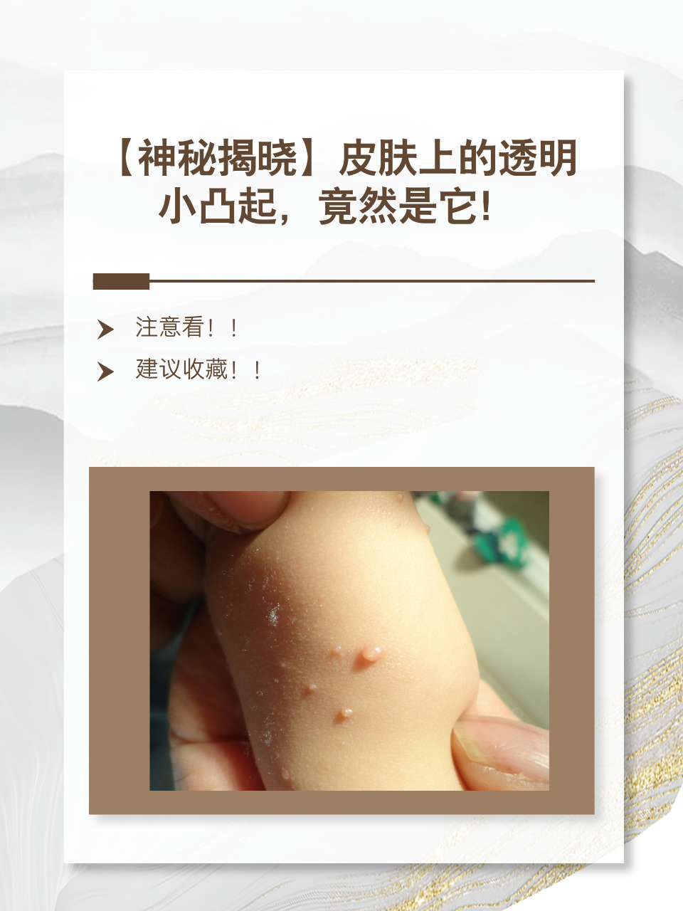 关于皮肤上长透明