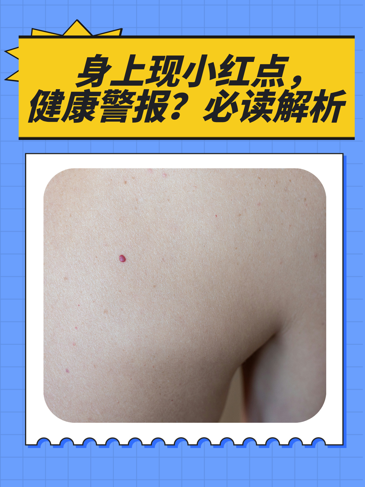 必读解析 今天来聊聊一个让人有点担心的问题