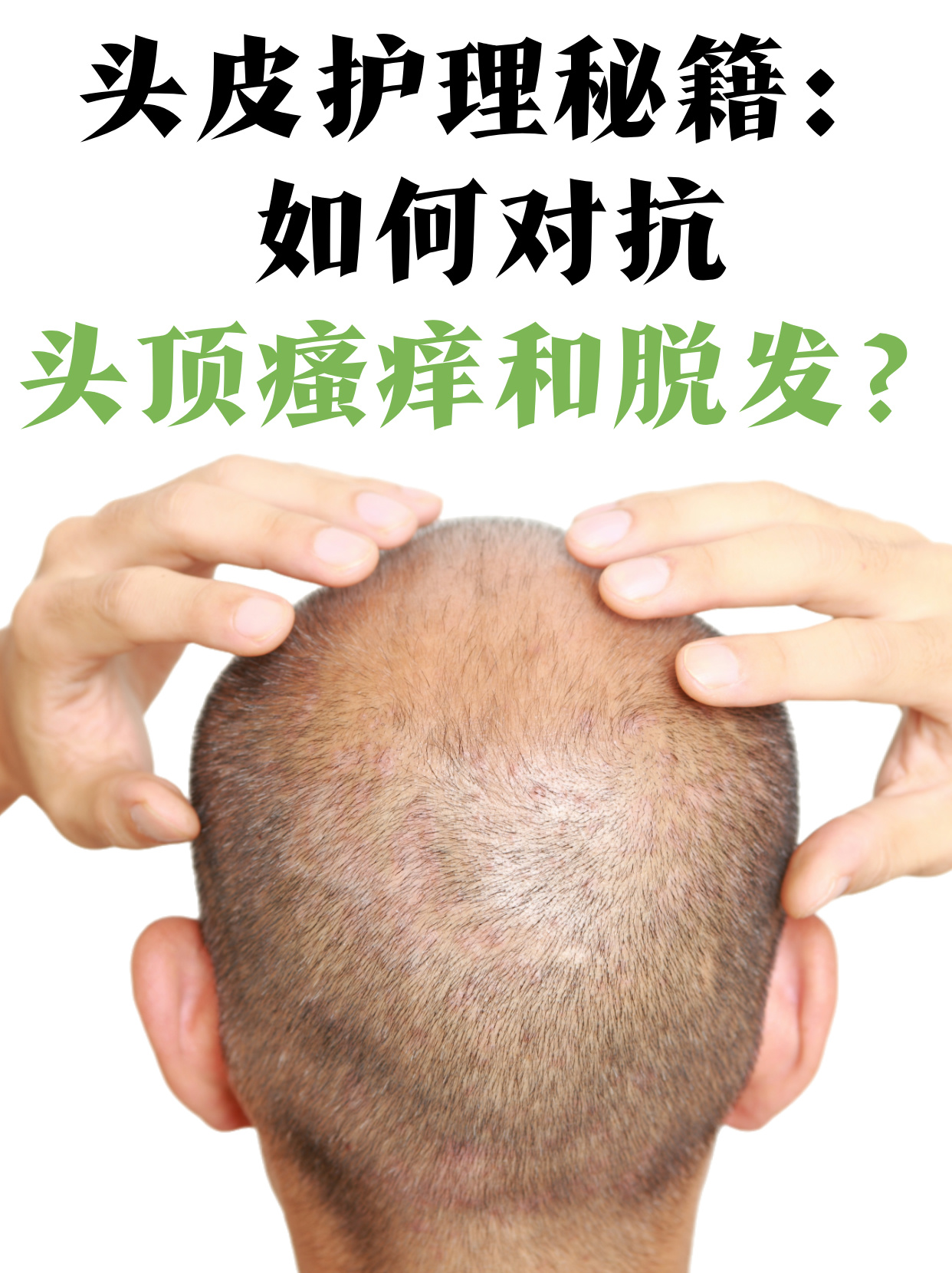 为什么头皮很痒很痒百科在线