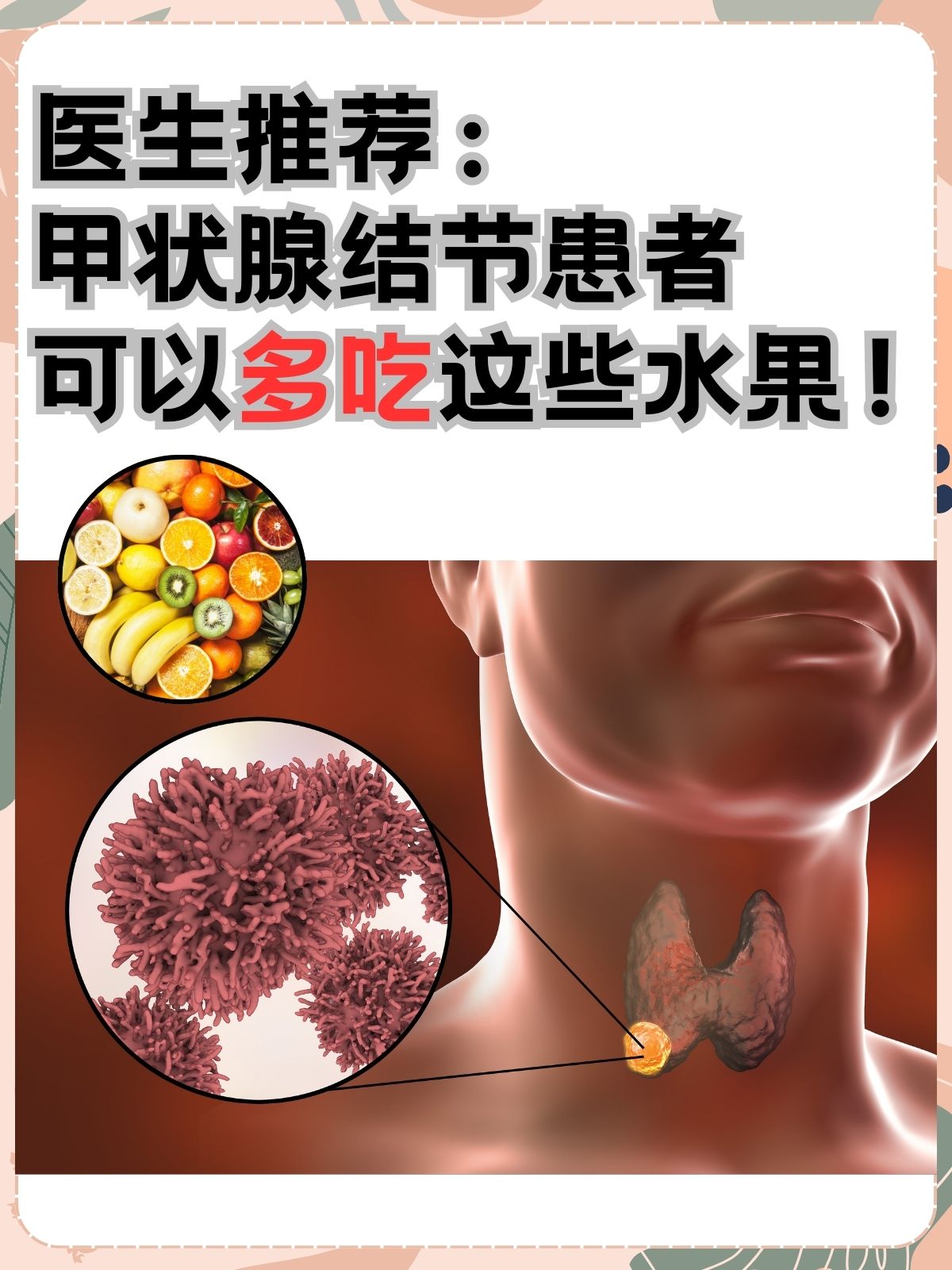 甲状腺不能吃的水果图片