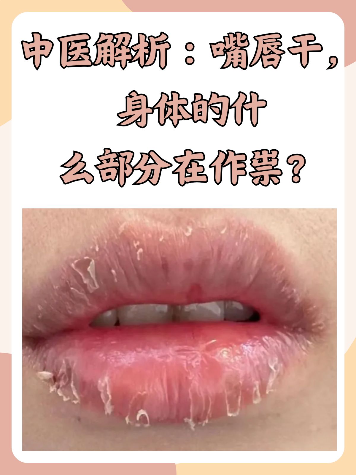 嘴唇为什么老是脱皮指甲总是会弯曲为什么在线 嘴唇为什么老是脱皮指甲总是会弯曲为什么在线