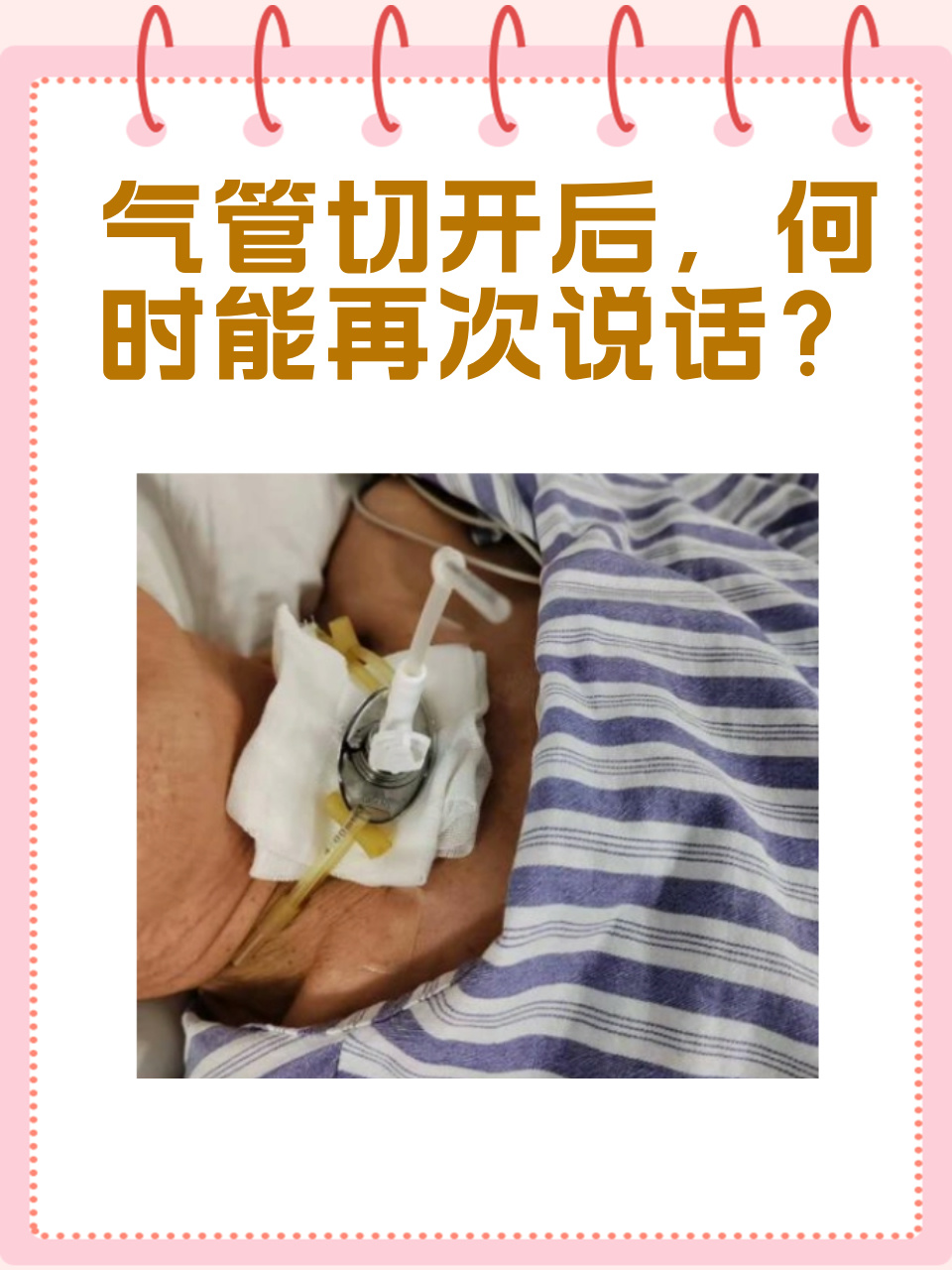 今天我们来聊一个很多人关心的问题