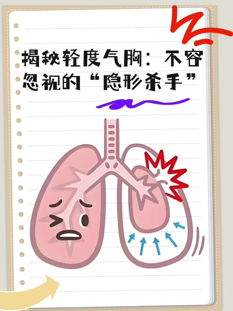 揭秘轻度气胸 不容忽视的隐形杀手  轻度气胸