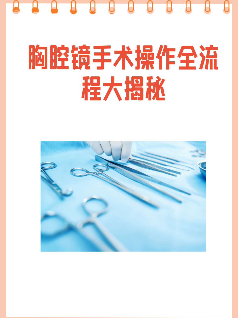 手术步骤胸腔镜微创手术科普图胸腔镜手术流程内科软式胸腔镜的全手术