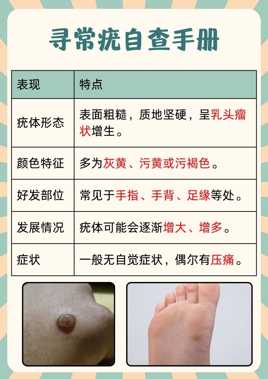 得了寻常疣别怕,轻松应对的治疗方法来袭06 90hello小伙伴们!