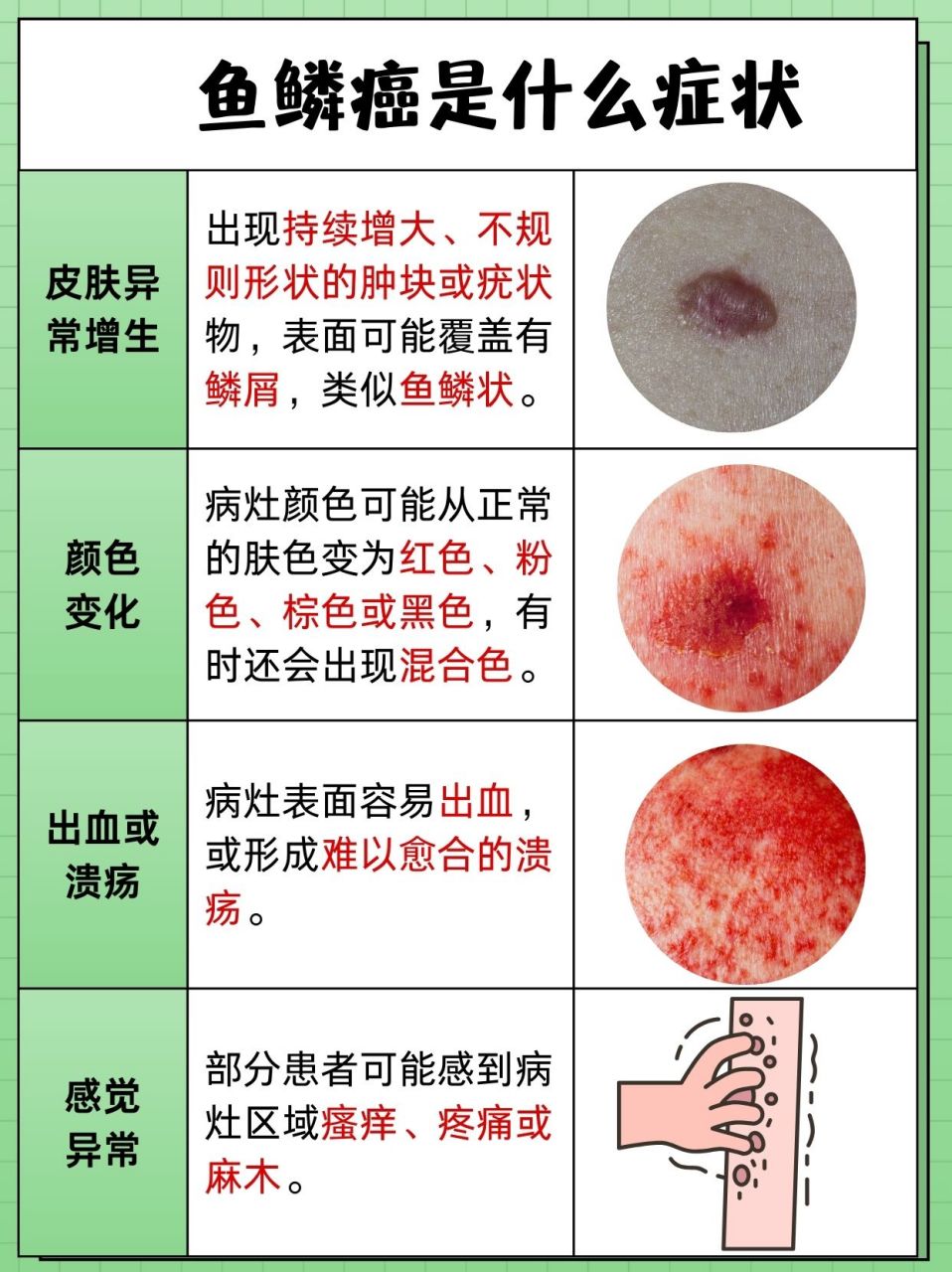 各种皮肤癌图片 区别图片