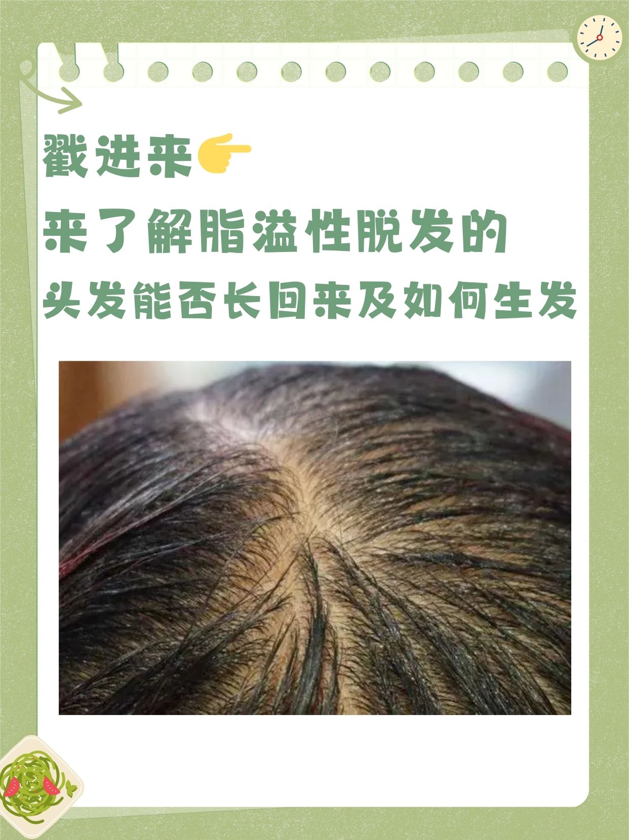 脂溢性脱发的病人积极