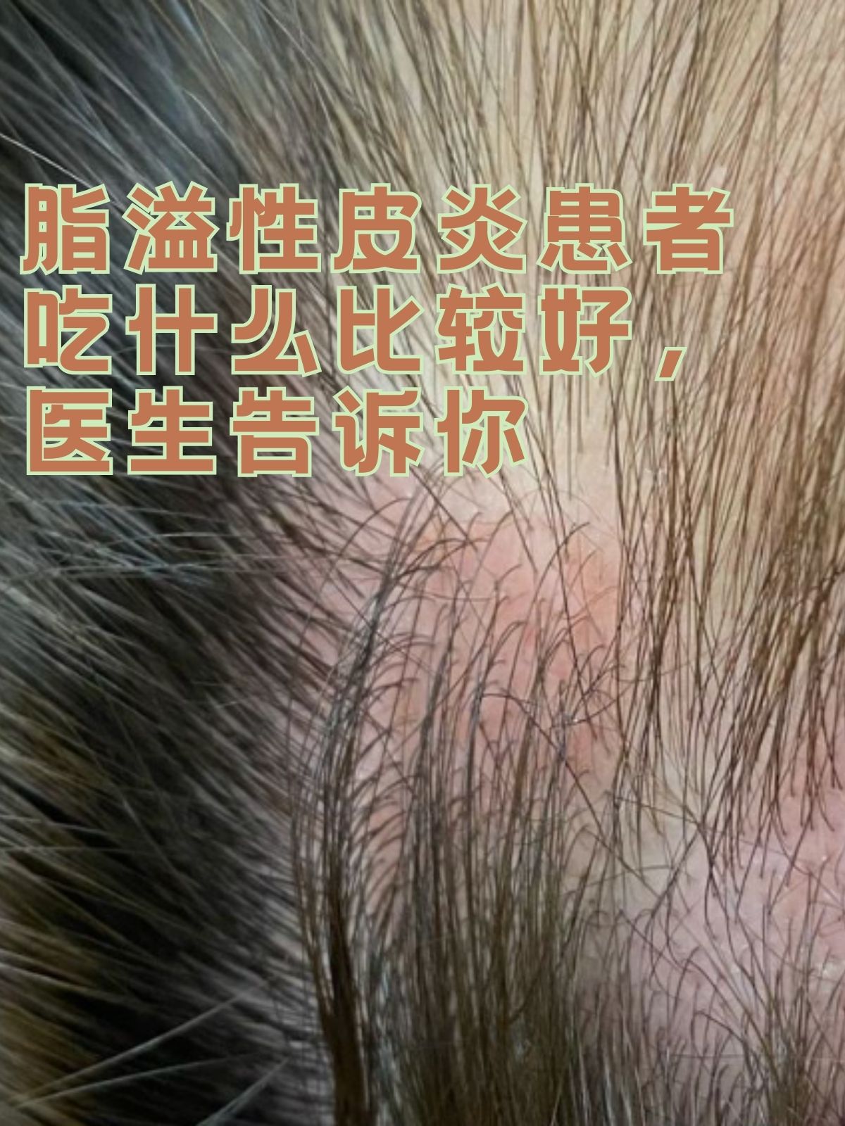 香蕉过敏症状图片大全图片