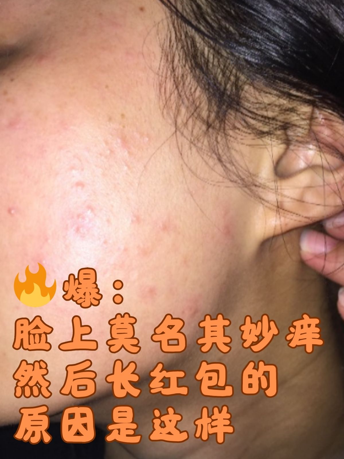脸上为什么痒