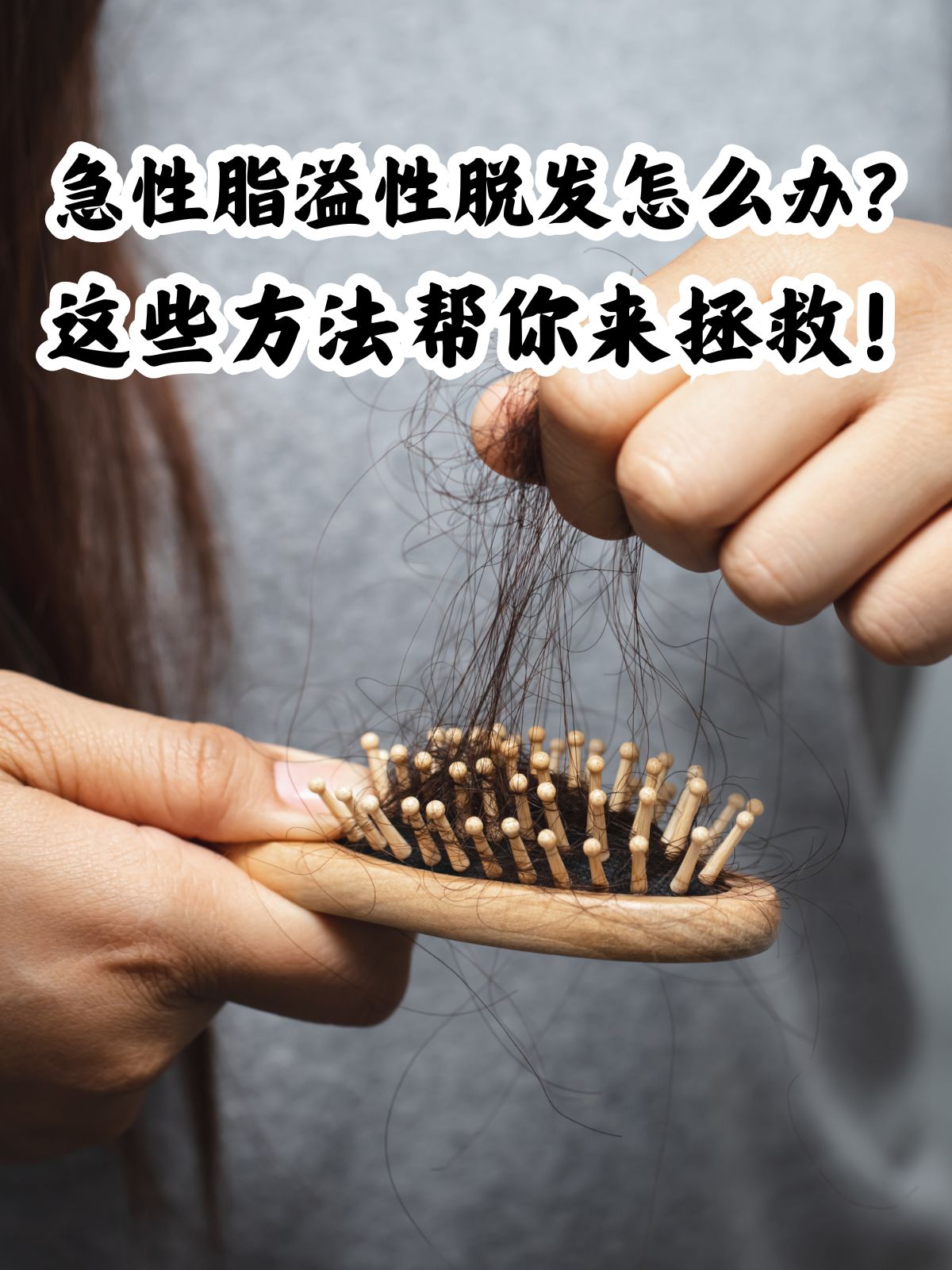 急性脂溢性脱发,一个困扰着许多人的问题,不仅影响外貌,还可能对自
