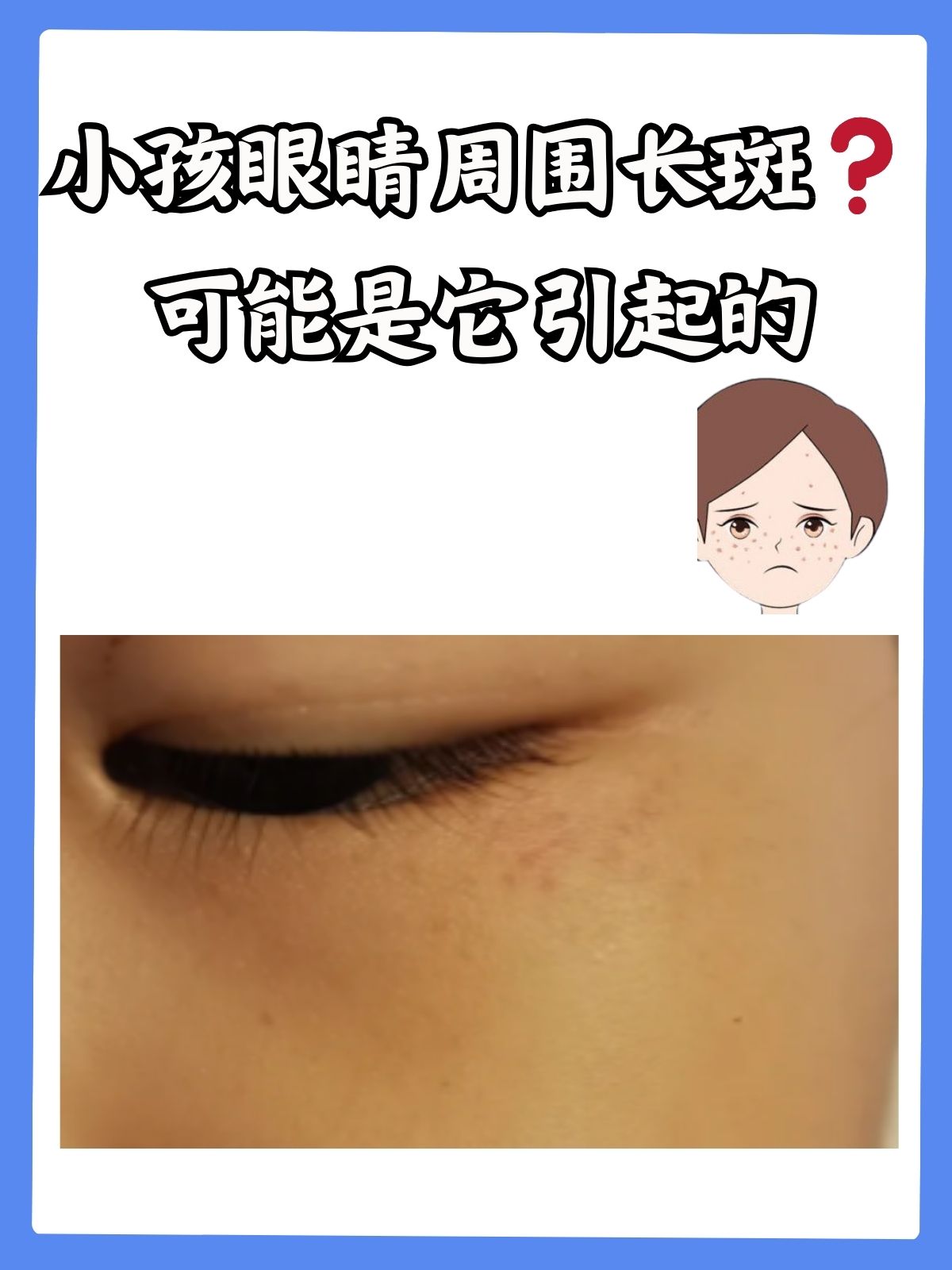 脸上为什么长斑