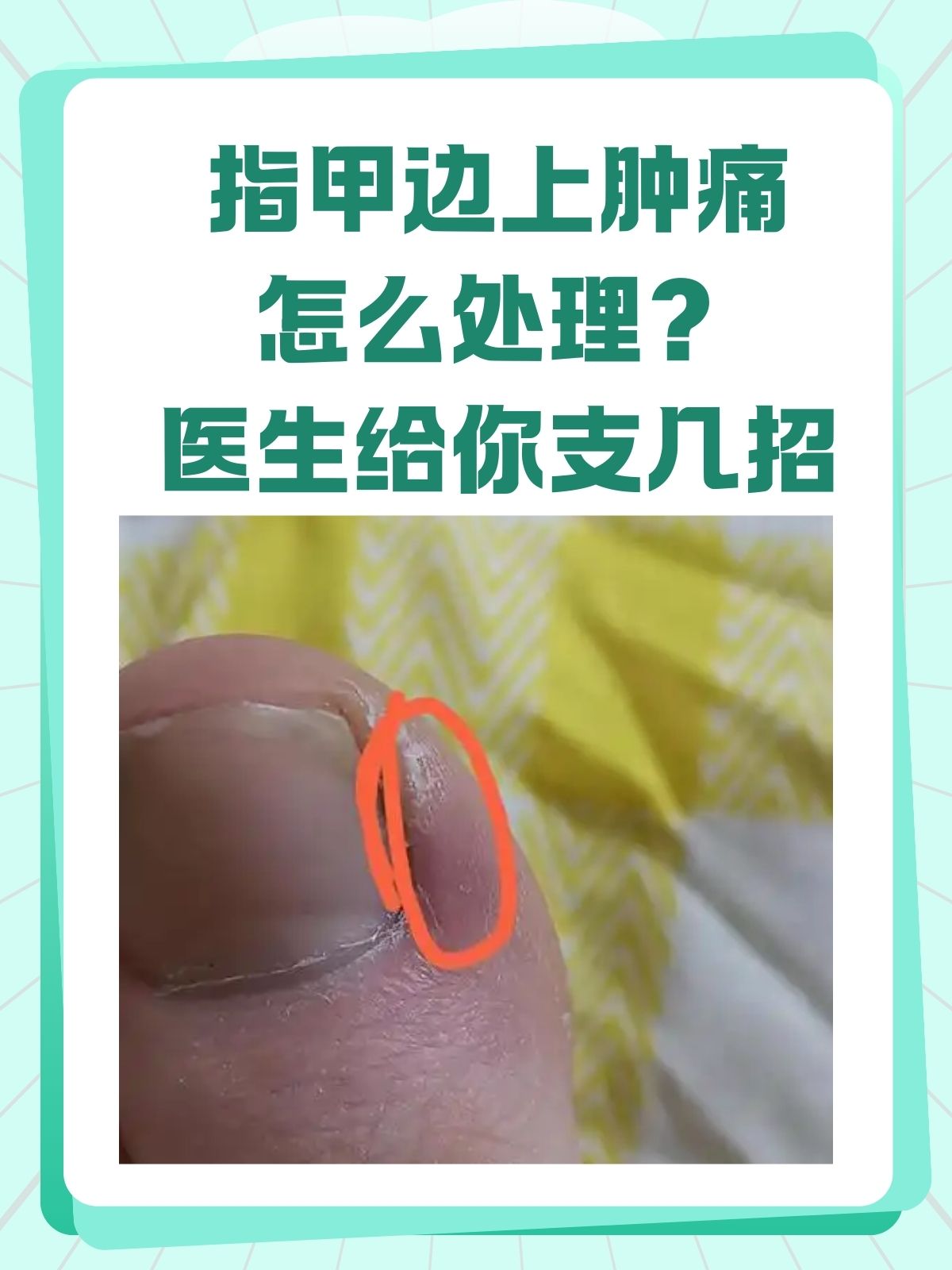 为什么会有指甲