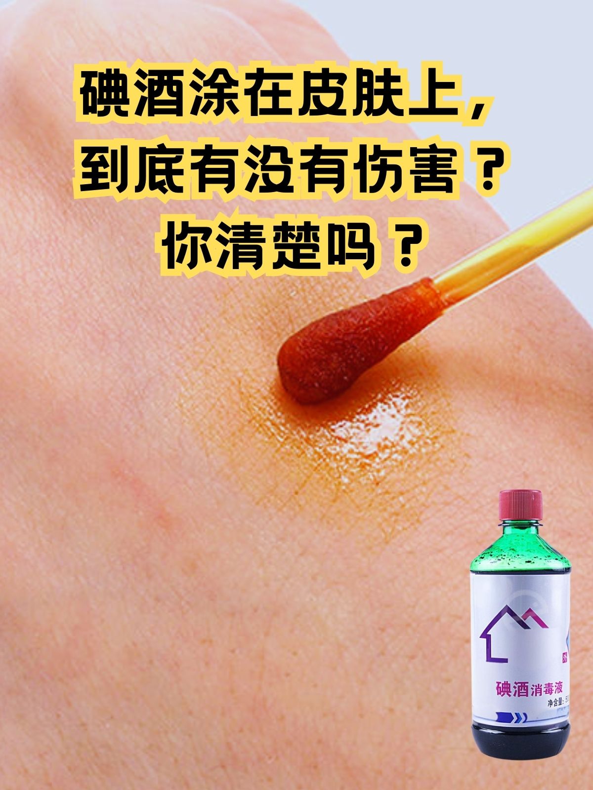 碘酒,这一常见的外用消毒防腐剂,在医疗和日常生活中极为常见