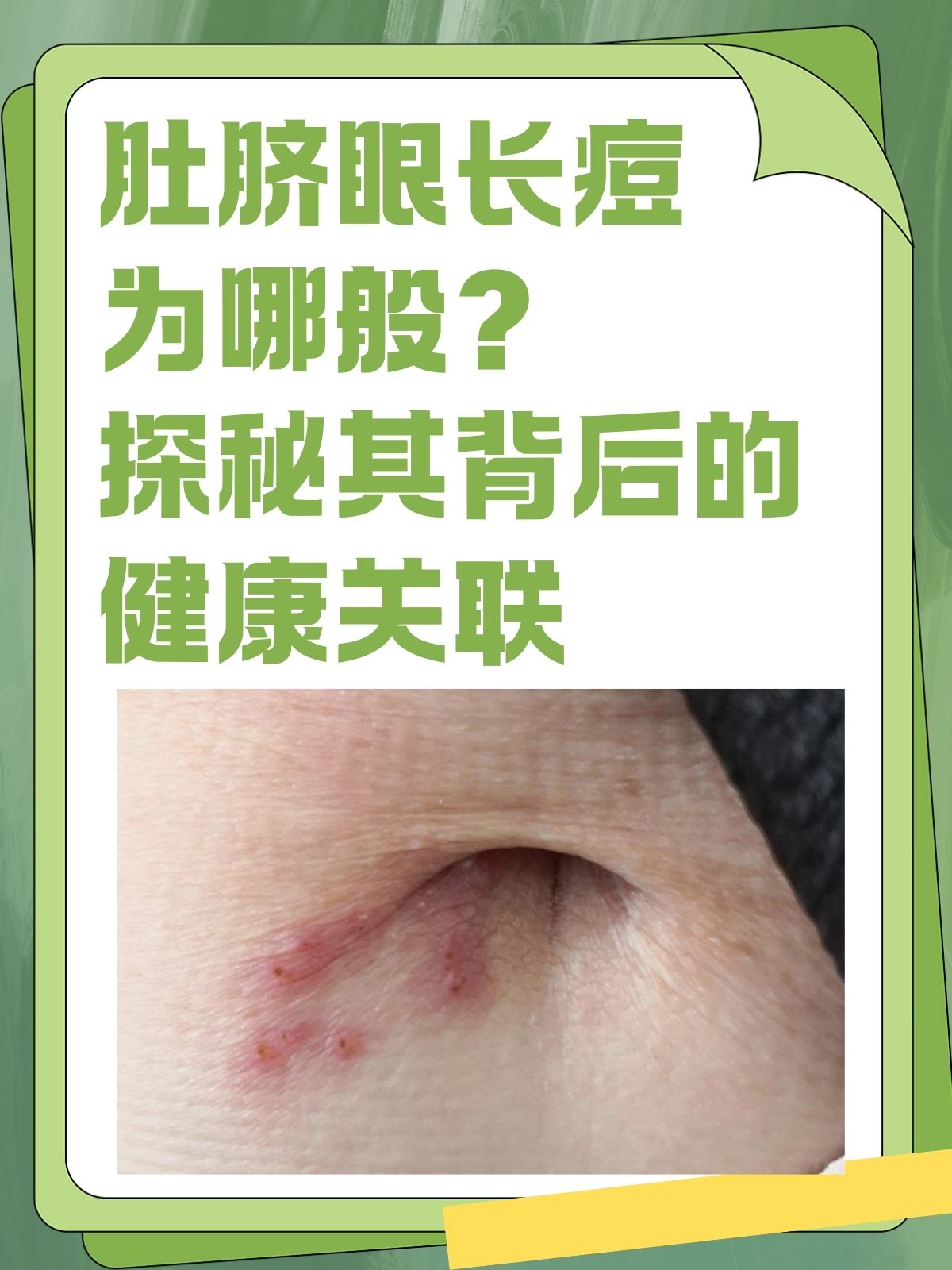 为什么肚脐眼那么臭百科在线 为什么肚脐眼那么臭百科在线