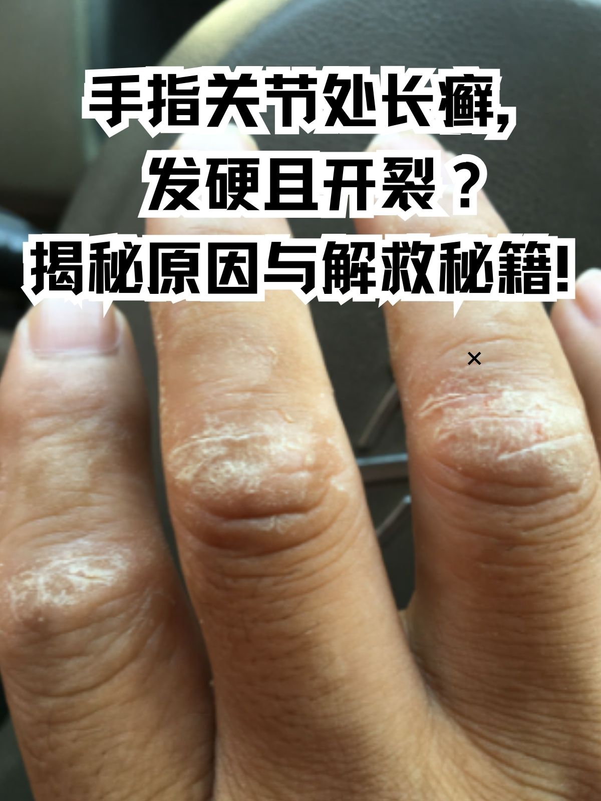 为什么手指有很多皱纹