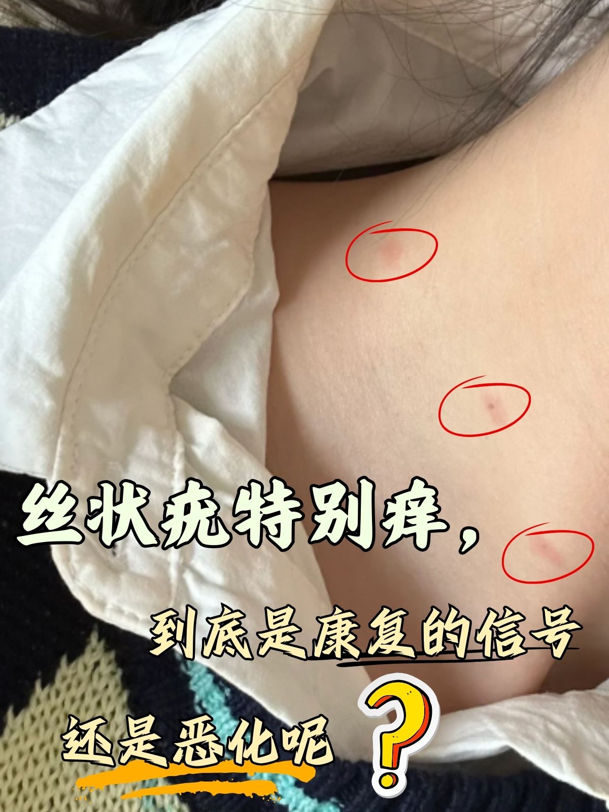 感染引起的皮肤良性丝状疣图片hpv都有什么症状感染hpv有