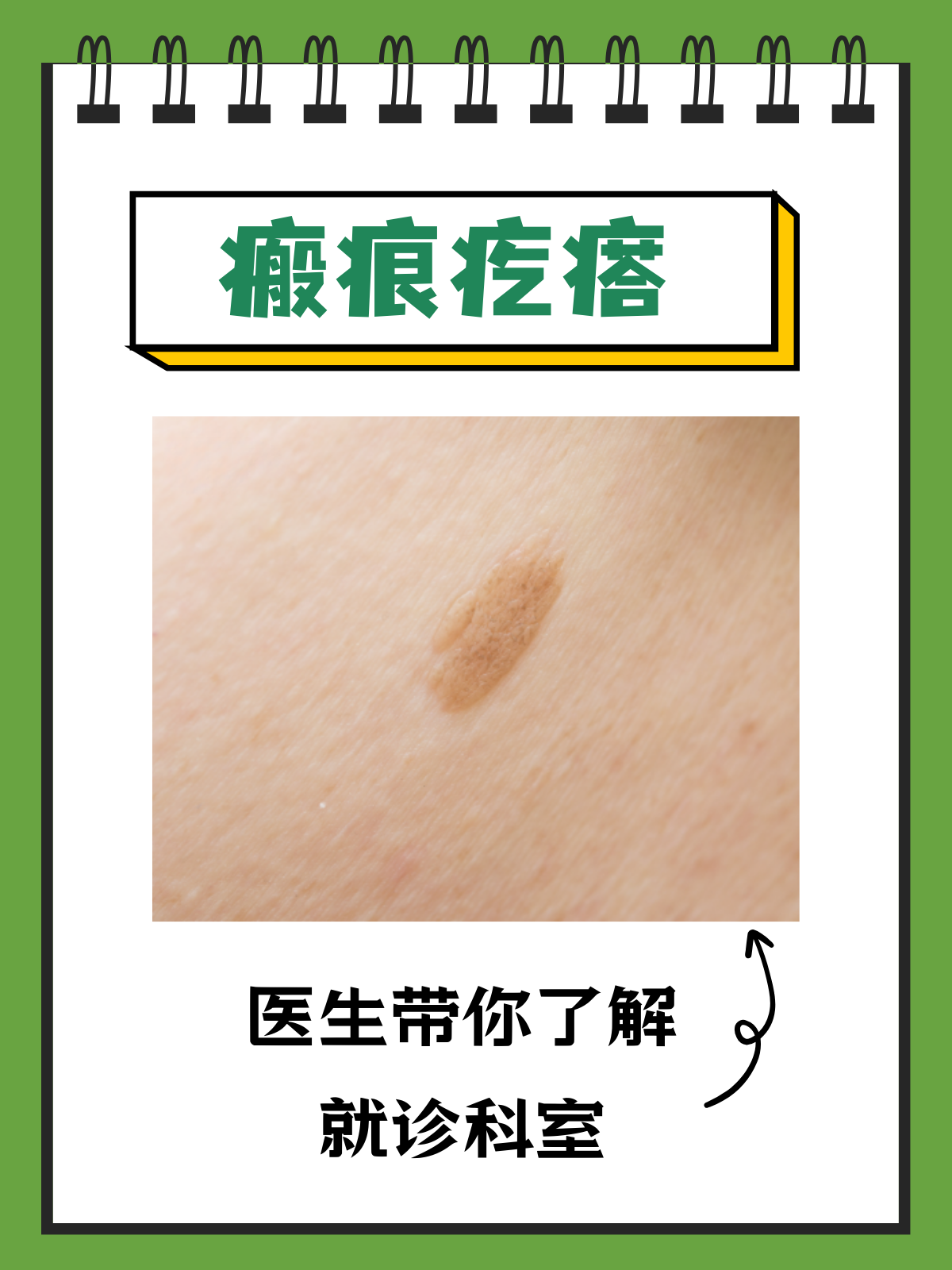 疤痕为什么会增生?为什么在线