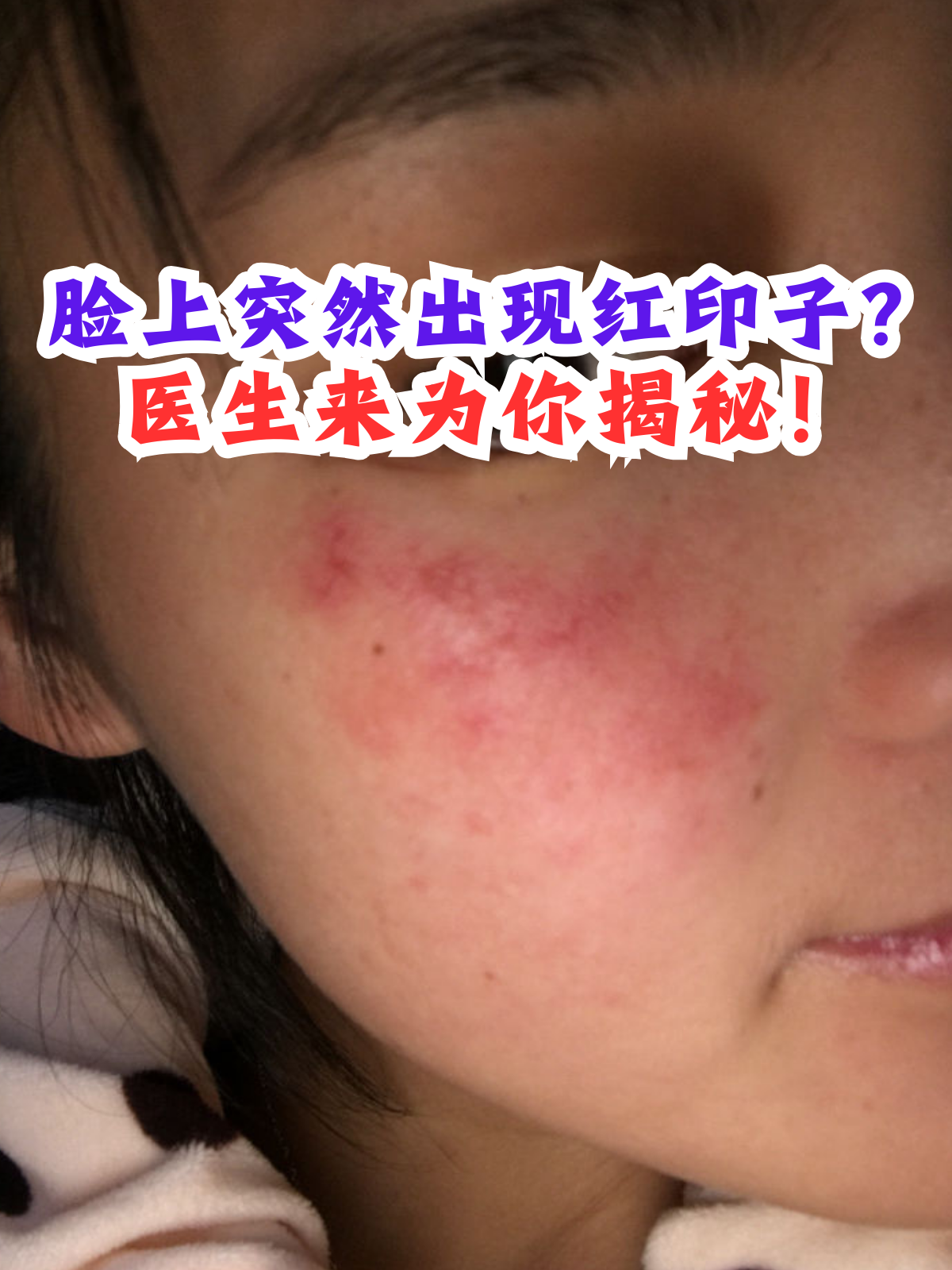 医生来为你揭秘!