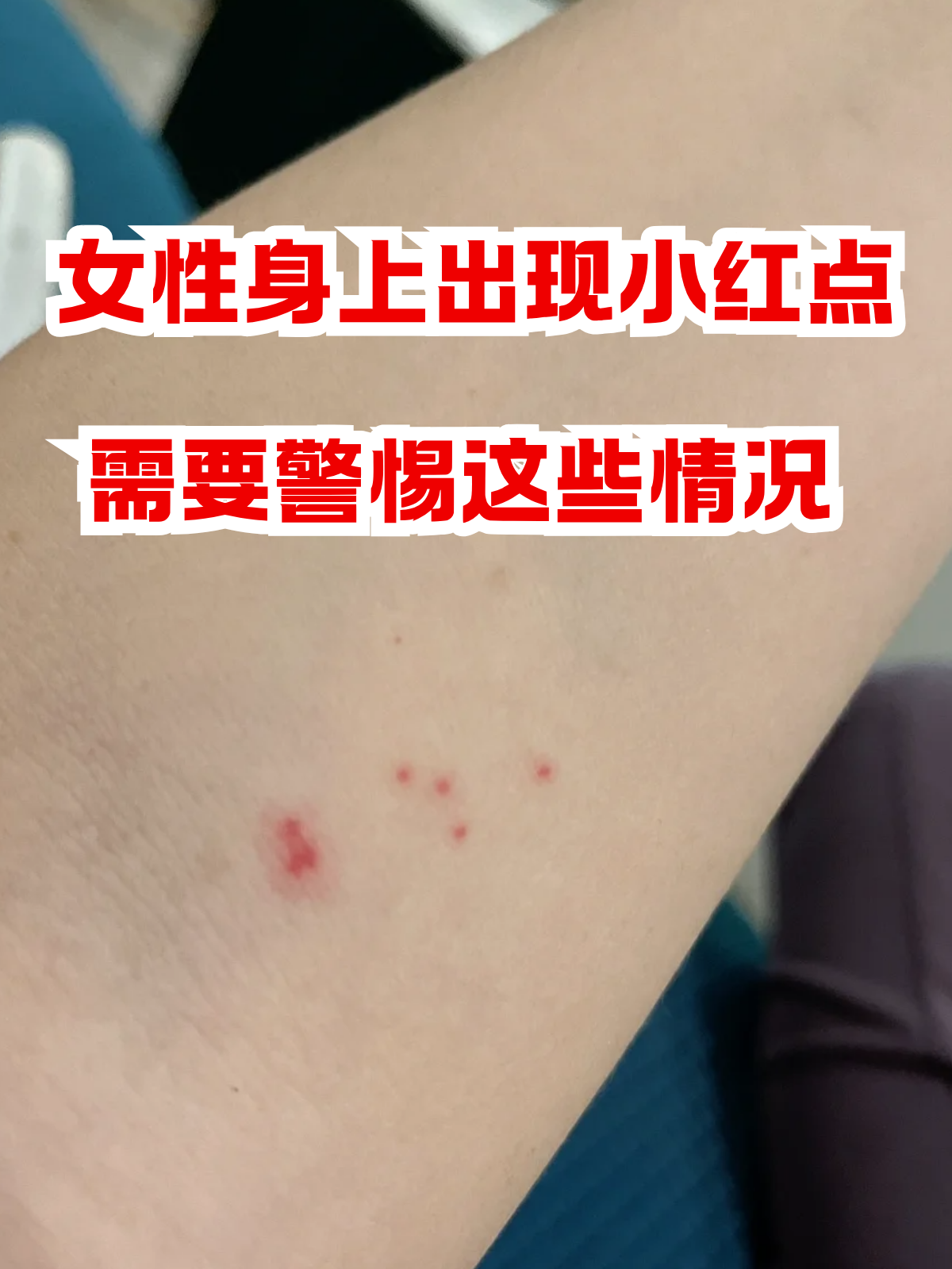 今天咱们就来好好分析分析,让大家心里有个底!