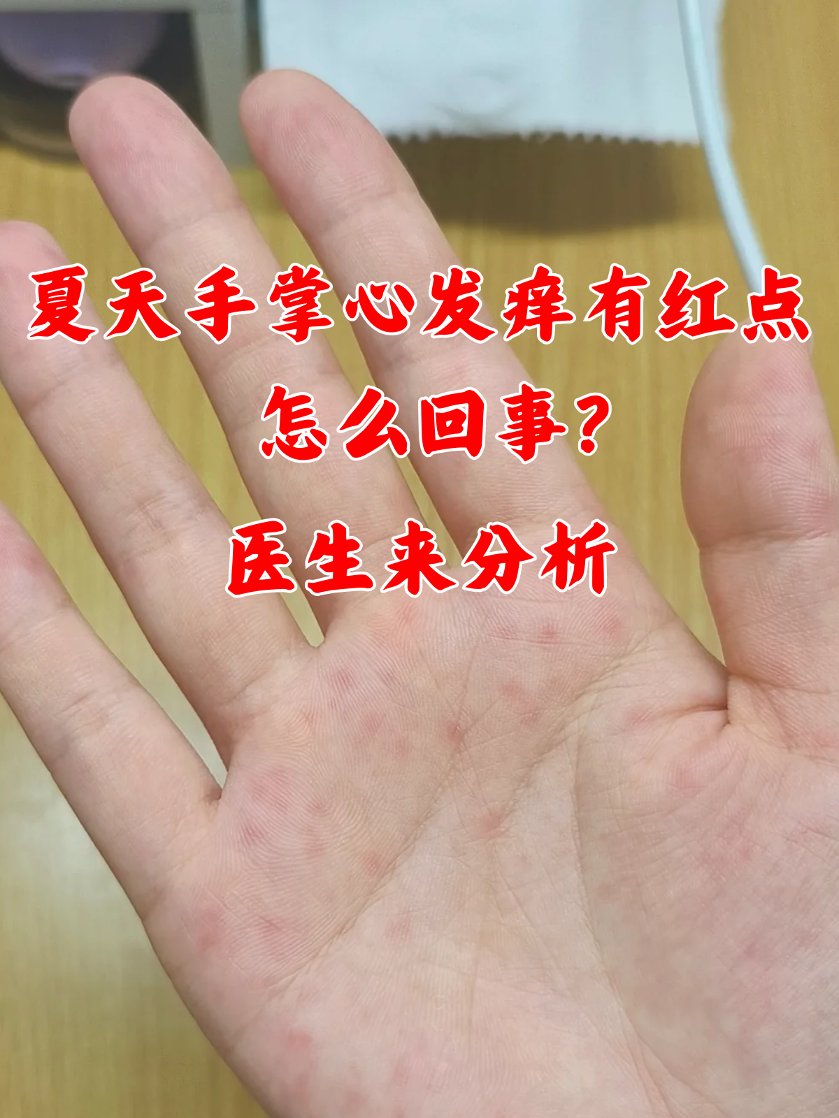 旧书摸起来手为什么会痒为什么在线 旧书摸起来手为什么会痒为什么在线