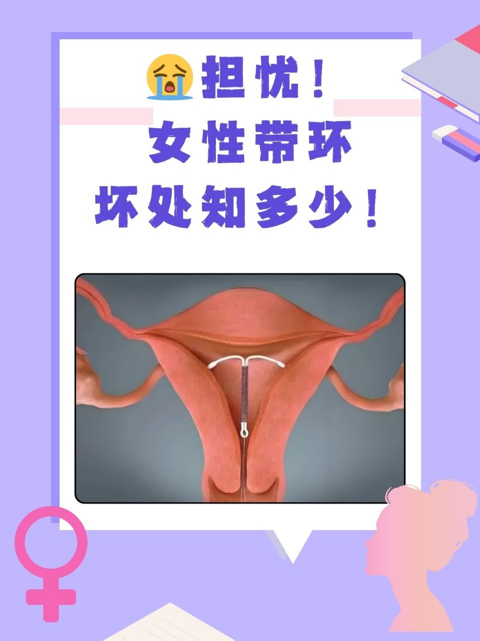 97女性带环(放置宫内节育器),真的万无一失吗?