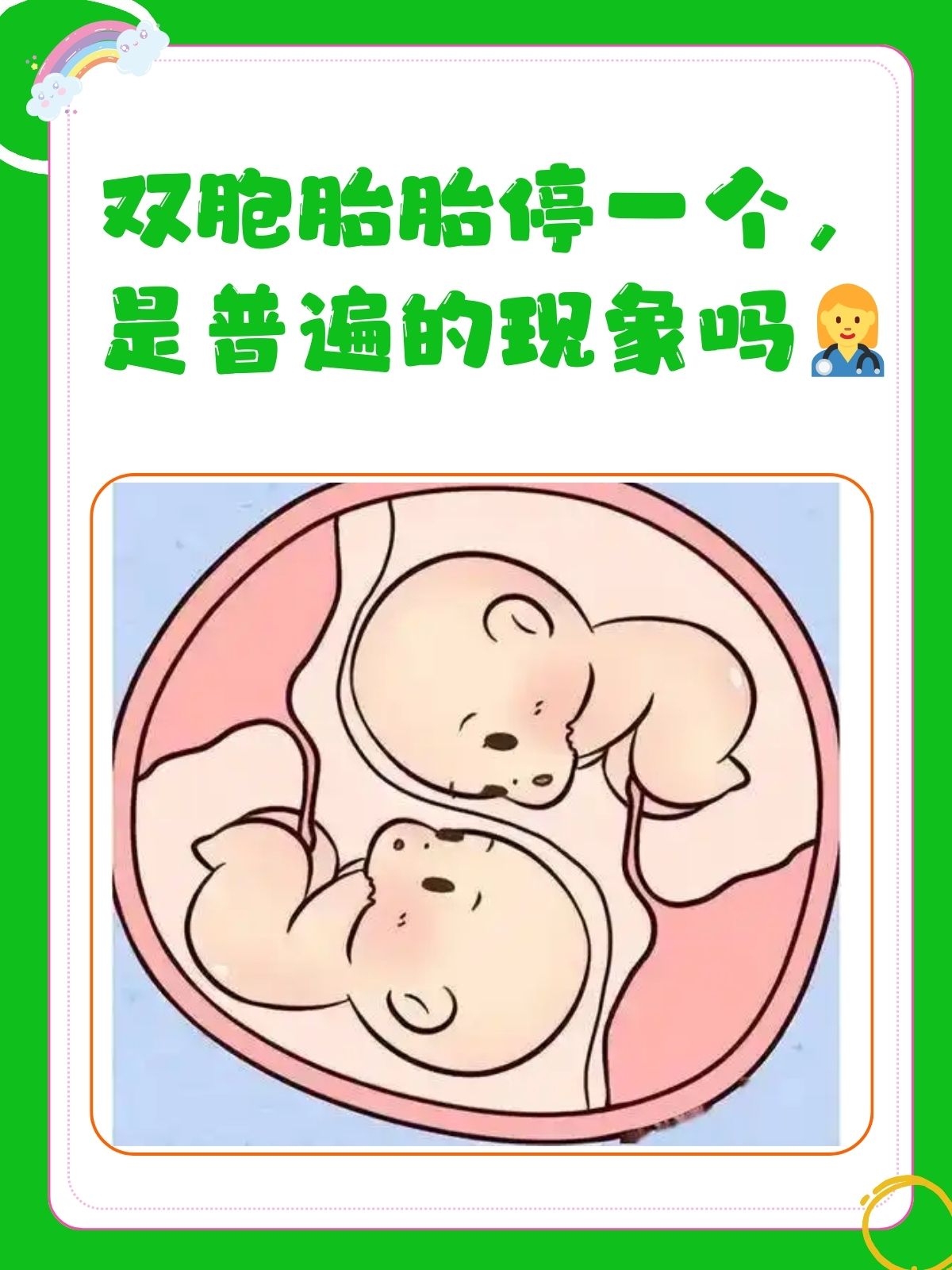 双胞胎胎停一个,是普遍的现象吗 双胞胎是指两个胎儿