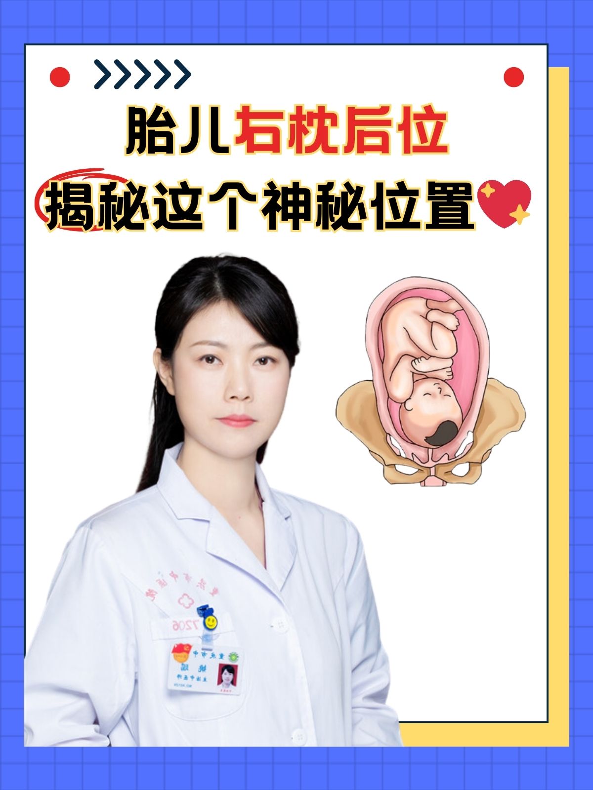 胎儿右枕后位这个听起来有点专业的术语,到底是什么意思呢?