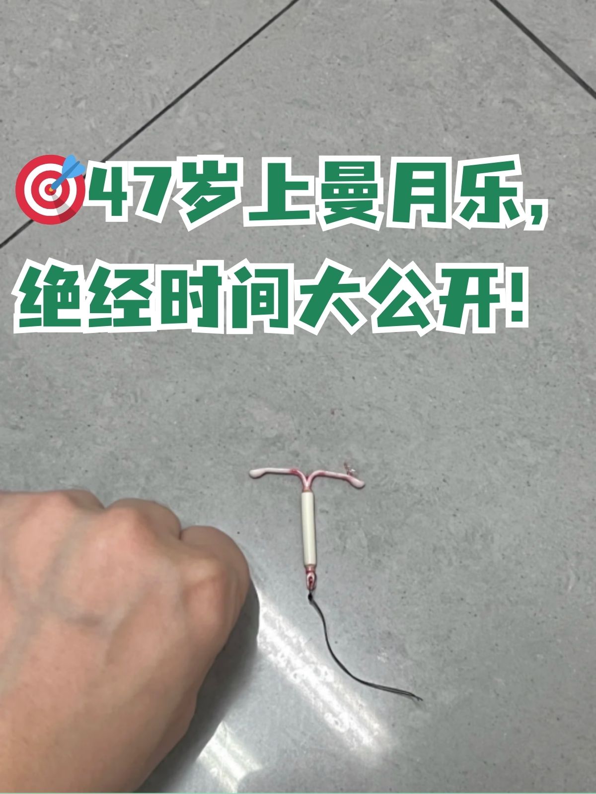 ,作为一种宫内节育系统,不仅能够有效