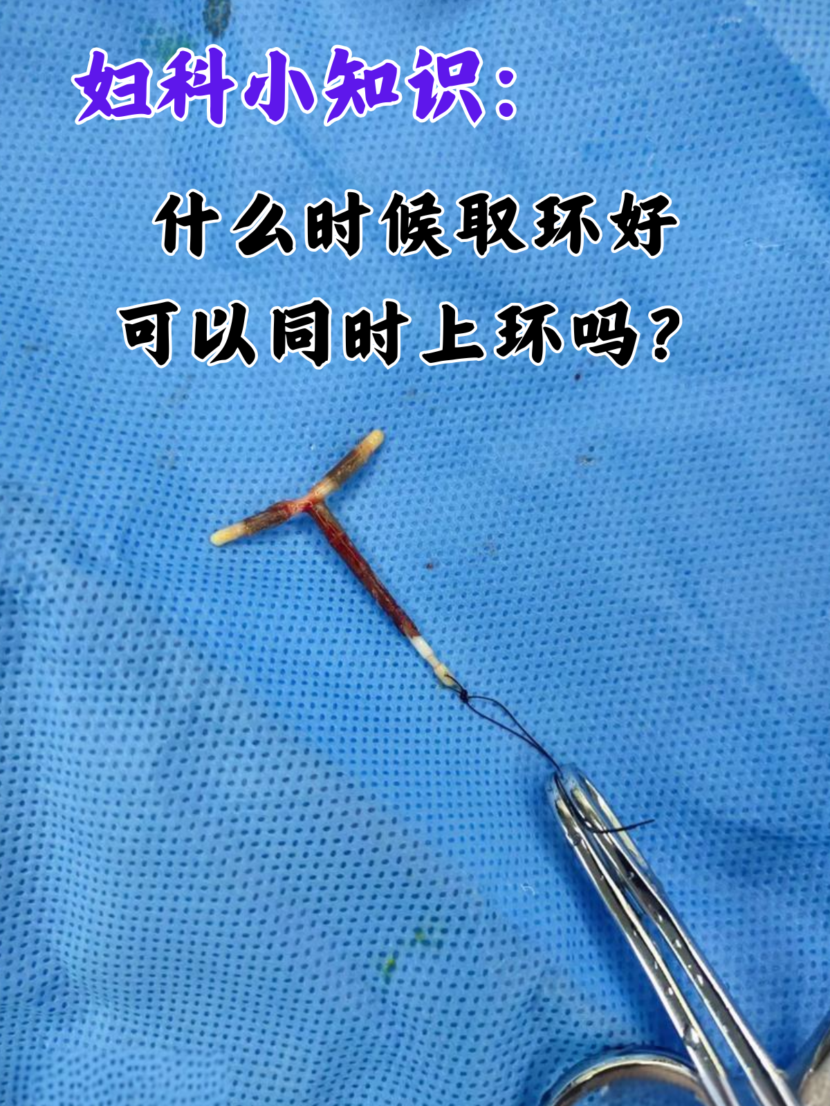 节育环作为一种长效,便捷的避孕方式,被广泛运用在临床中,但是很多人