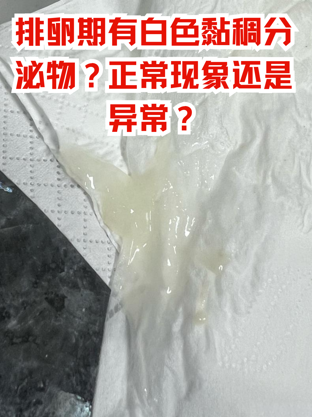 其中,白色黏稠分泌物的出现,让不少女性心生疑虑