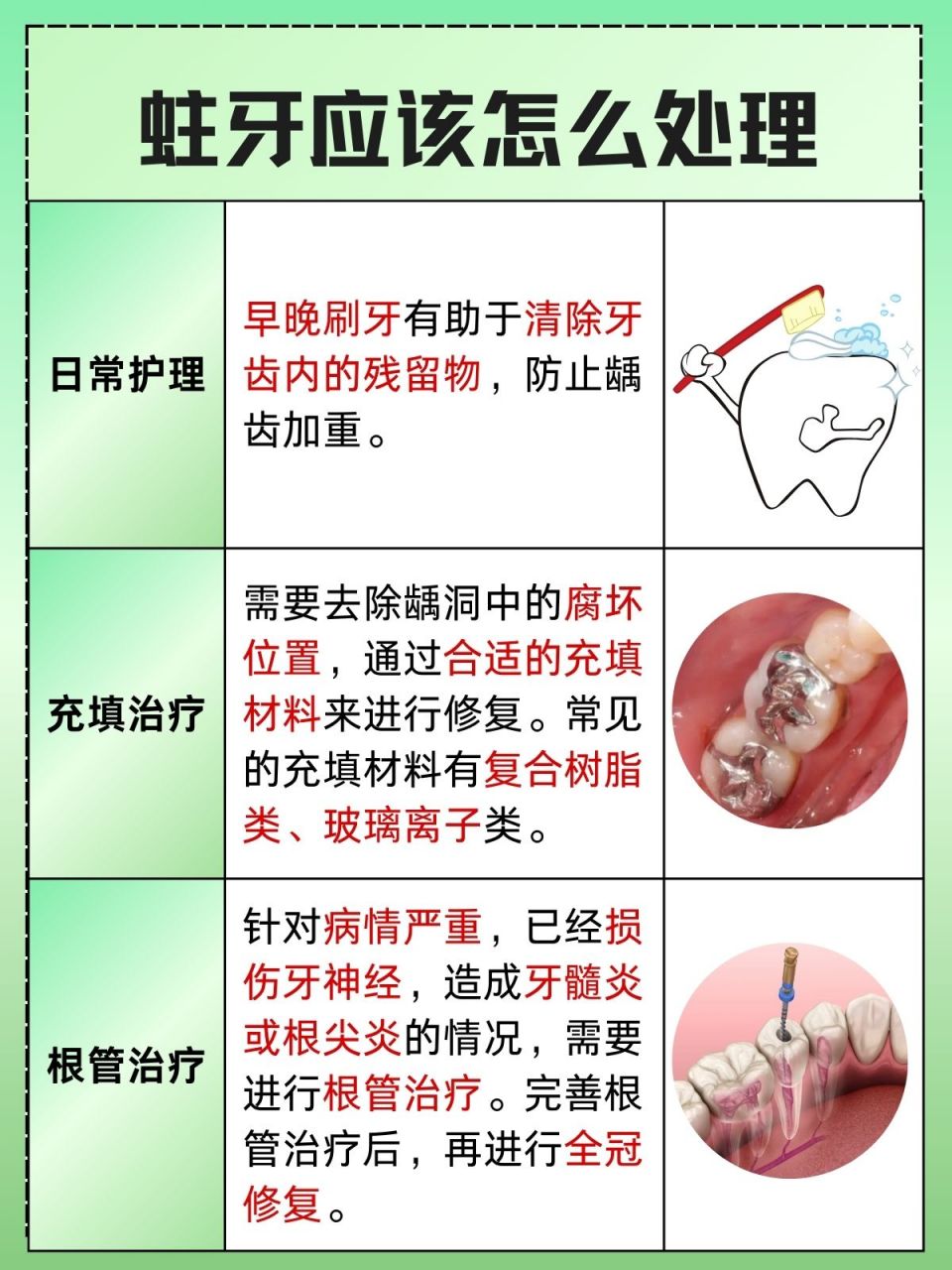 龋齿的发生是细菌,时间,宿主,食物共同作用的结果,出现蛀牙以后,在