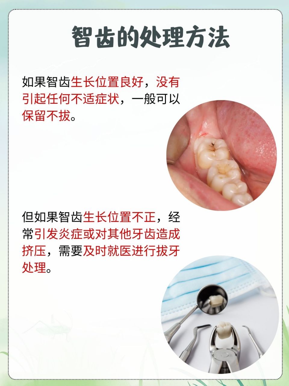 智齿盲袋会自己消退吗图片