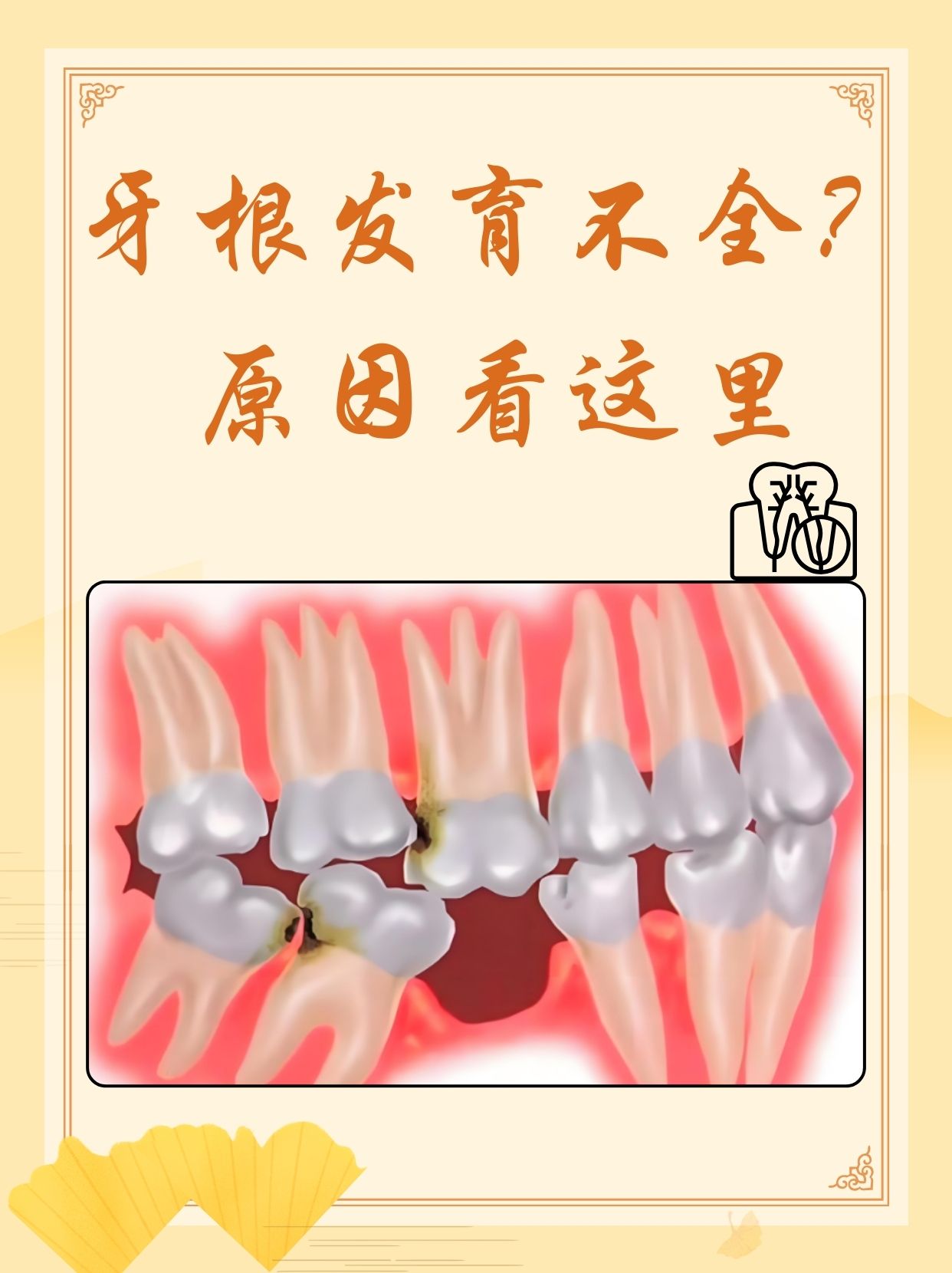 牙本质发育不良图片